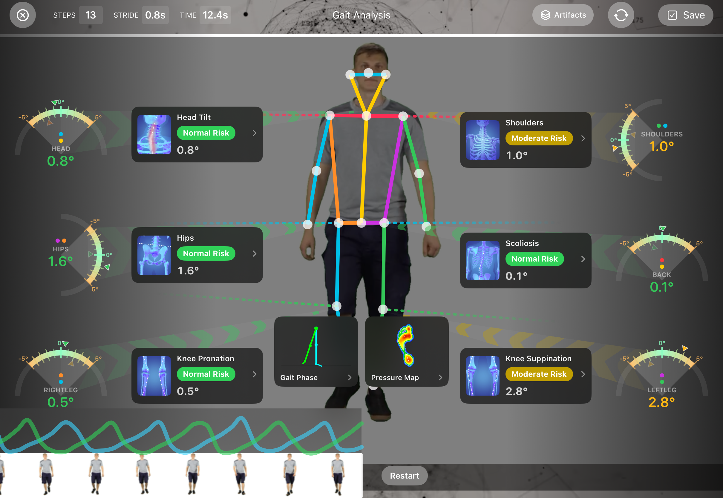 Gait analysis with risk-graded joint angles in FitsPro